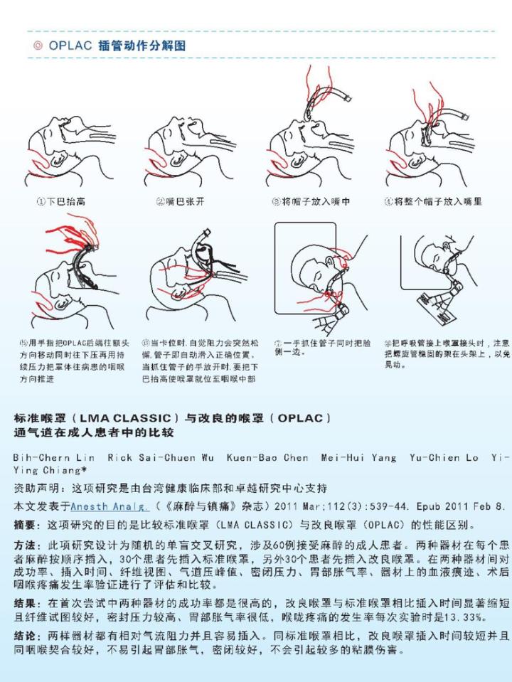 喉罩结构图片