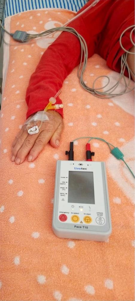 美敦力临时起搏器